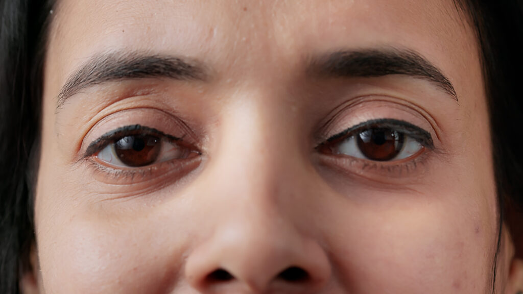Eye Hospital in Vijaynagar Bangalore