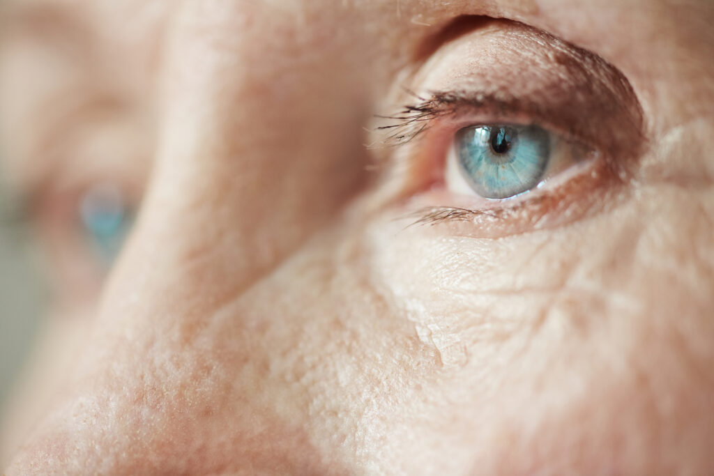 Cataract Surgery in Vijayanagar